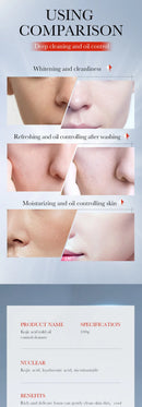 Kojic Acid Skin Care Facial Wash Mild Oil Control Deep Cleaning Moisturizing Cleansing Nonirritating Face Cleanser Face Wash